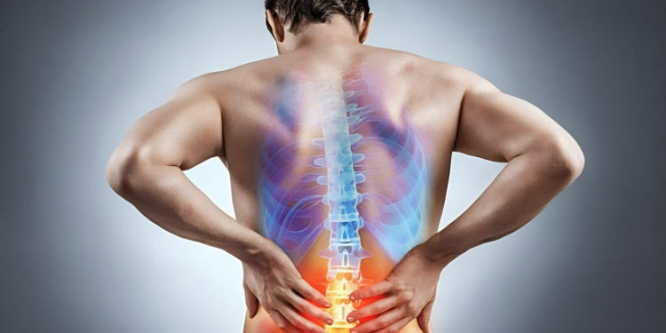 Bệnh thoát vị đĩa đệm là gì? Nguyên nhân, triệu chứng và biện pháp phòng ngừa