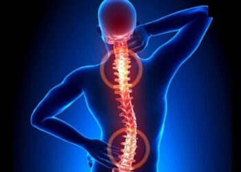 Thoát vị đĩa đệm nội xốp: Nguyên nhân, triệu chứng, chẩn đoán và cách điều trị