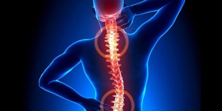 Thoát vị đĩa đệm nội xốp: Nguyên nhân, triệu chứng, chẩn đoán và cách điều trị