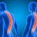 Viêm cột sống dính khớp: Ảnh hưởng của chế độ ăn và cách chăm sóc