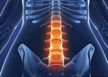 Viêm cột sống dính khớp là gì? Triệu chứng và cách điều trị