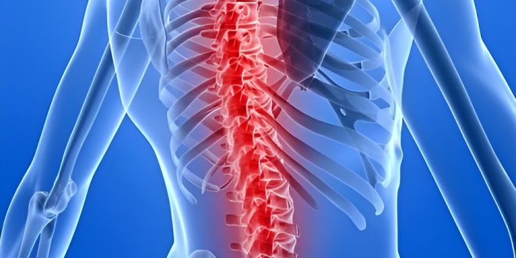Bệnh lao xương: Nguyên nhân, triệu chứng và cách điều trị