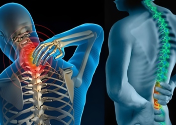Gai xương là gì? Nguyên nhân, triệu chứng và cách điều trị
