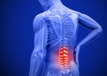 Hẹp ống sống: Nguyên nhân, triệu chứng và cách điều trị