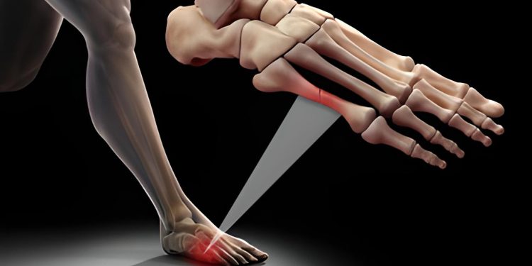 Rạn xương là gì? Nguyên nhân, dấu hiệu và cách điều trị