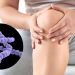 Viêm khớp liên cầu: Nguyên nhân, dấu hiệu và cách điều trị