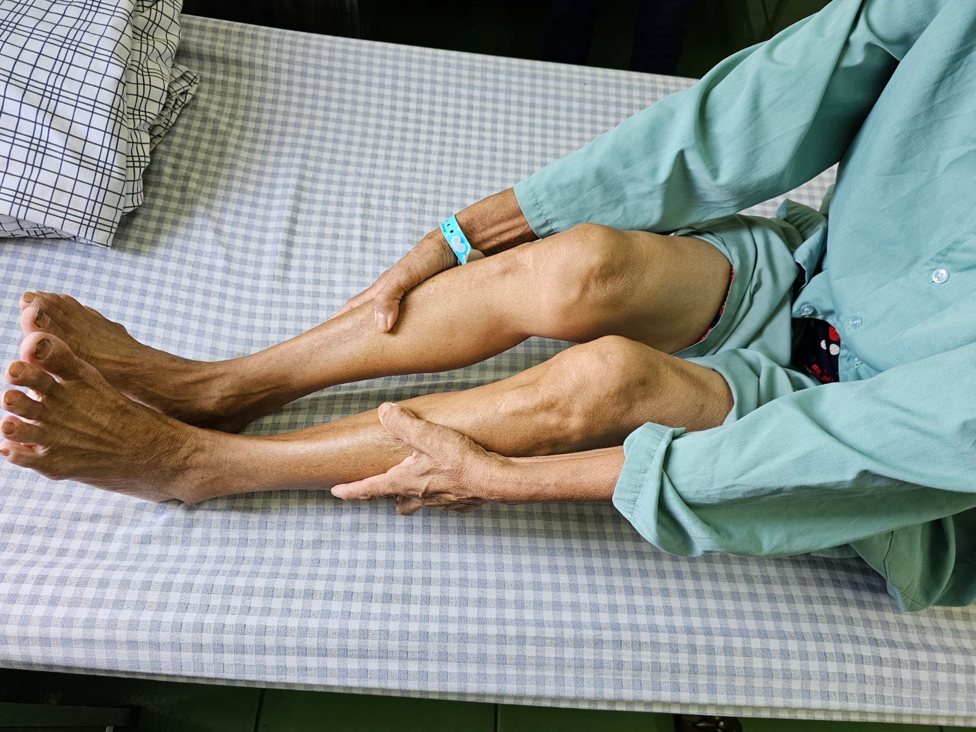 Bác sĩ thực hiện những phương pháp như đeo nẹp, thay đốt sống nhân tạo