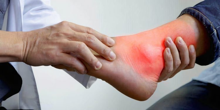 Đau mắt cá chân là bệnh gì? Nguyên nhân, triệu chứng và cách điều trị bệnh