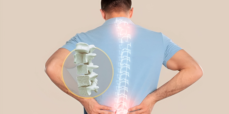 Bệnh nhuyễn xương là gì? Nguyên nhân, dấu hiệu và điều trị