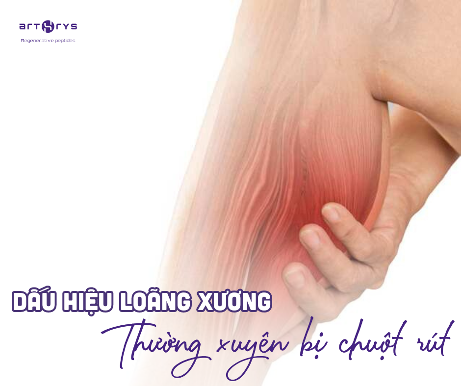 Dấu hiệu của loãng xương là thường xuyên bị chuột rút