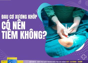 Đau Cơ Xương Khớp có nên tiêm không? 