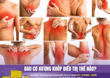 Đau Cơ Xương Khớp điều trị thế nào? 