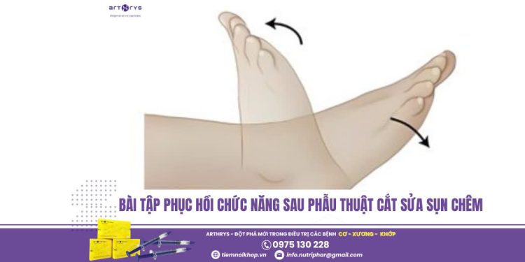 Bài tập phục hồi chức năng sau phẫu thuật cắt sửa sụn chêm