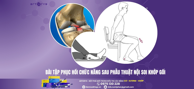 Bài tập phục hồi chức năng sau phẫu thuật nội soi khớp gối