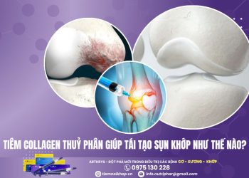 Tiêm Collagen thủy phân giúp tái tạo sụn khớp như thế nào? 