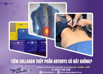Tiêm Collagen thủy phân Arthrys có đắt không?