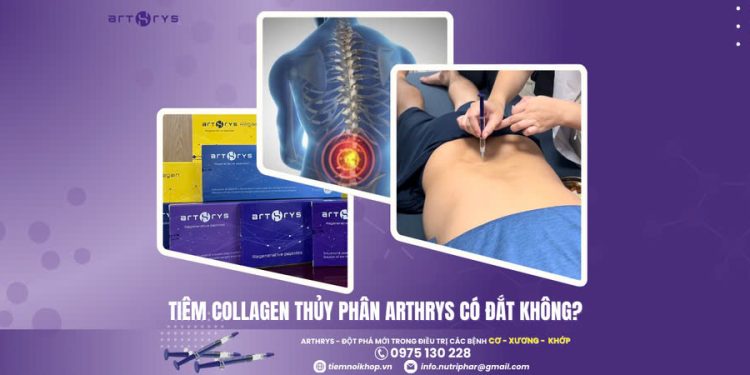 Tiêm Collagen thủy phân Arthrys có đắt không?