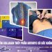 Tiêm Collagen thủy phân Arthrys có đắt không?