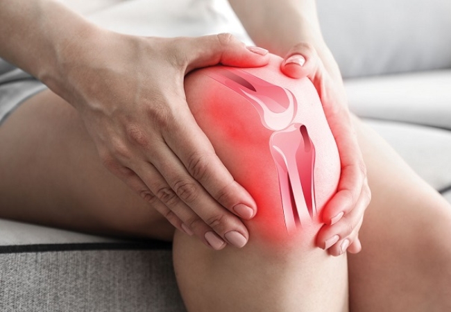 Thoái hóa khớp gối là bệnh mãn tính tiến triển theo quá trình lão hóa