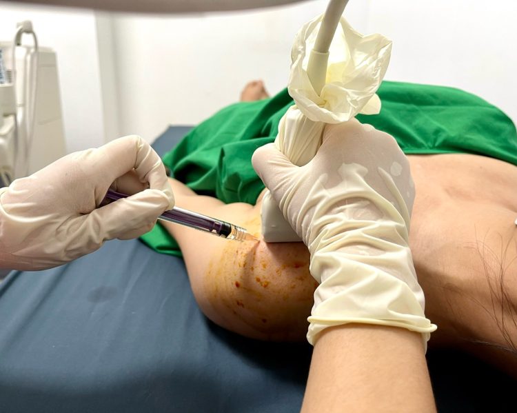 Arthrys điều trị hiệu quả trên rất nhiều bệnh nhân bệnh cơ xương khớp như thoái hóa, chấn thương, bệnh hệ thống và viêm gân, cơ, dây chằng