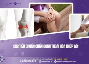 Các tiêu chuẩn chẩn đoán thoái hóa khớp gối