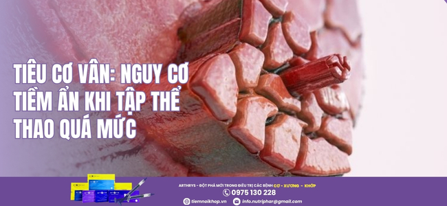 Tiêu cơ vân: Nguy cơ tiềm ẩn khi tập thể thao quá mức