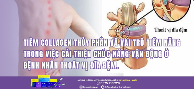 Collagen thủy phân Arthrys giúp bảo vệ cột sống cho bệnh nhân thoát vị đĩa đệm