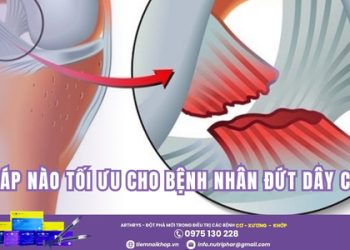 Giải pháp điều trị nào tối ưu cho bệnh nhân tổn thương dây chằng?