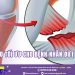 Giải pháp điều trị nào tối ưu cho bệnh nhân tổn thương dây chằng?